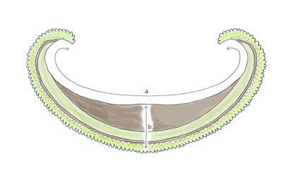 Thielenbruch