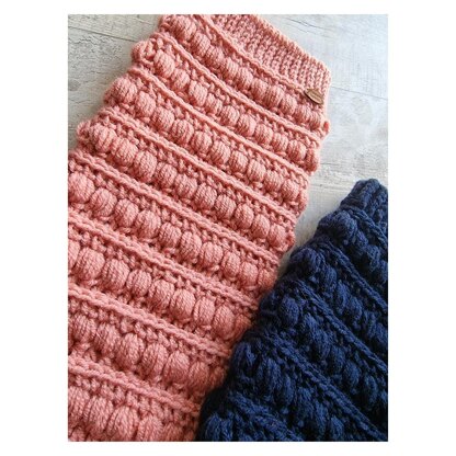 Bring back the legwarmers